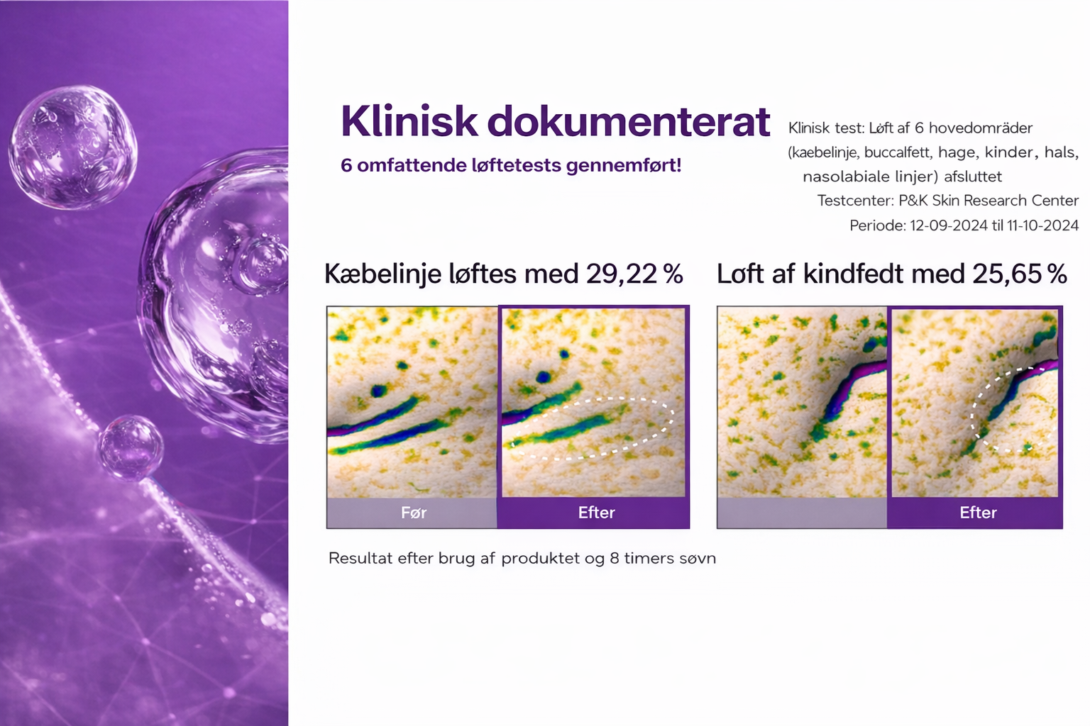 HudKlar™ – NAD+ Løfteserum & Maske